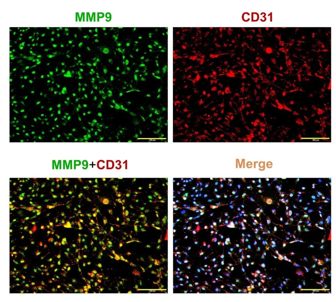 圖3 內(nèi)皮細(xì)胞中MMP-9的表達(dá)水平（標(biāo)尺大小為100μm）